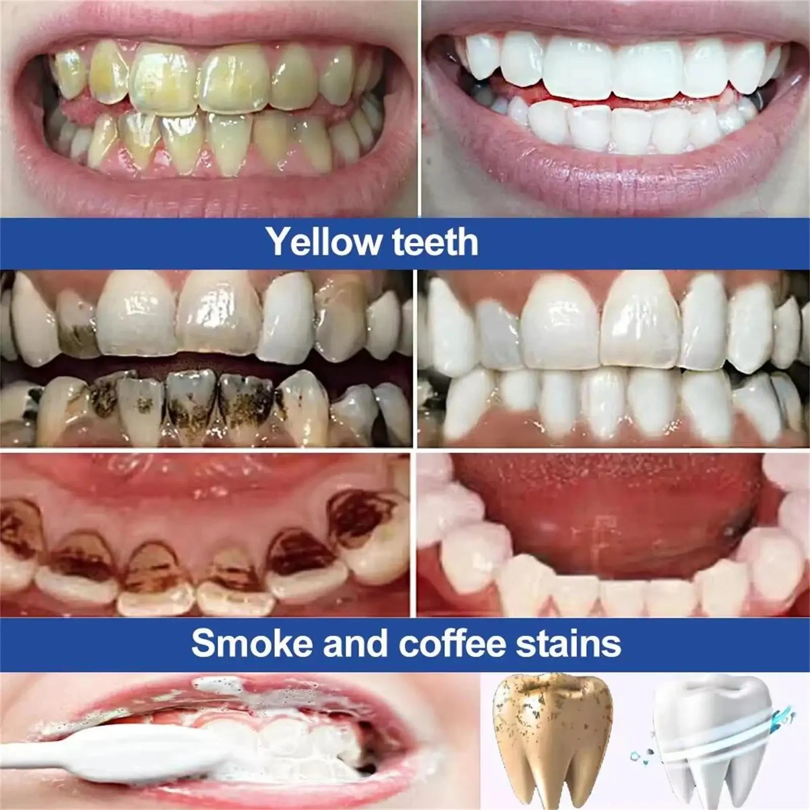 Teeth Whitening Powder